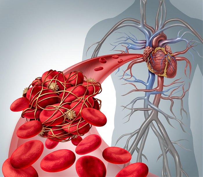 HOMOCYSTEIN – NEJDŮLEŽITĚJŠÍ ÚDAJ O VAŠEM ZDRAVOTNÍM STAVU